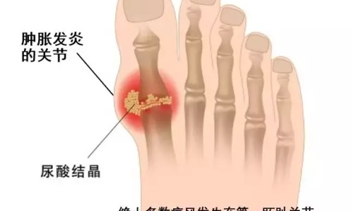 男癌症病人能生孩子吗视频-权威男人得了癌可以夫妻同居吗平台,分享专业男癌症病人能生孩子吗知乎知识_男癌症病人能生孩子吗网